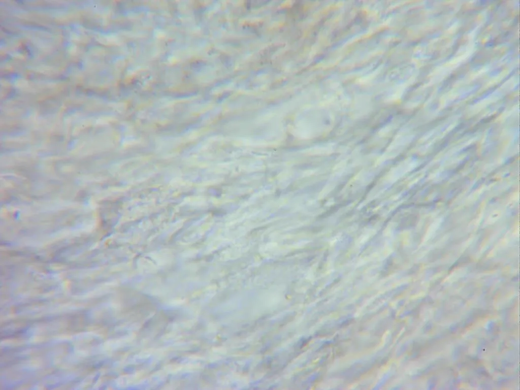 Microscopía de Rhytidhysteron rufulum - 14 - Excípulo